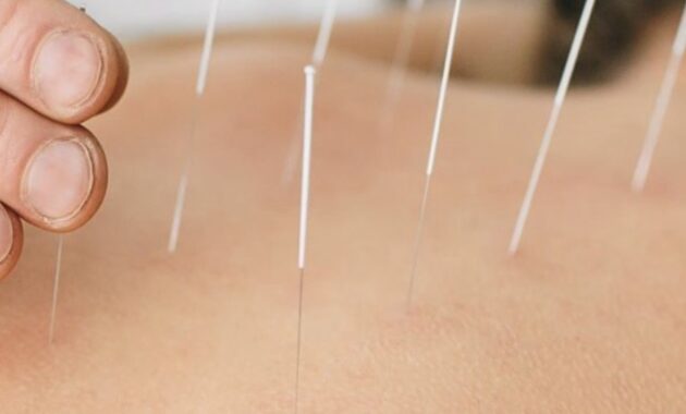 Pengobatan Tradisional China: Menyelaraskan Tubuh, Pikiran, dan Alam